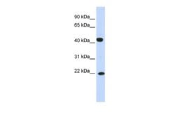 SSX4 Antibody, Novus Biologicals 100 &mu;L | Buy Online | Novus Biologicals | Fisher Scientific